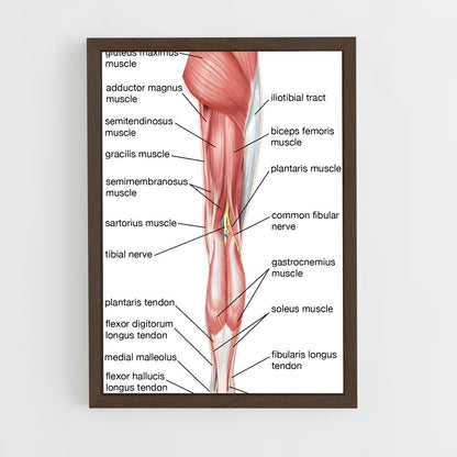 ap-thigh-2 cadre Bois foncé