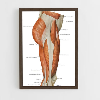ap-thigh-3 cadre Bois foncé