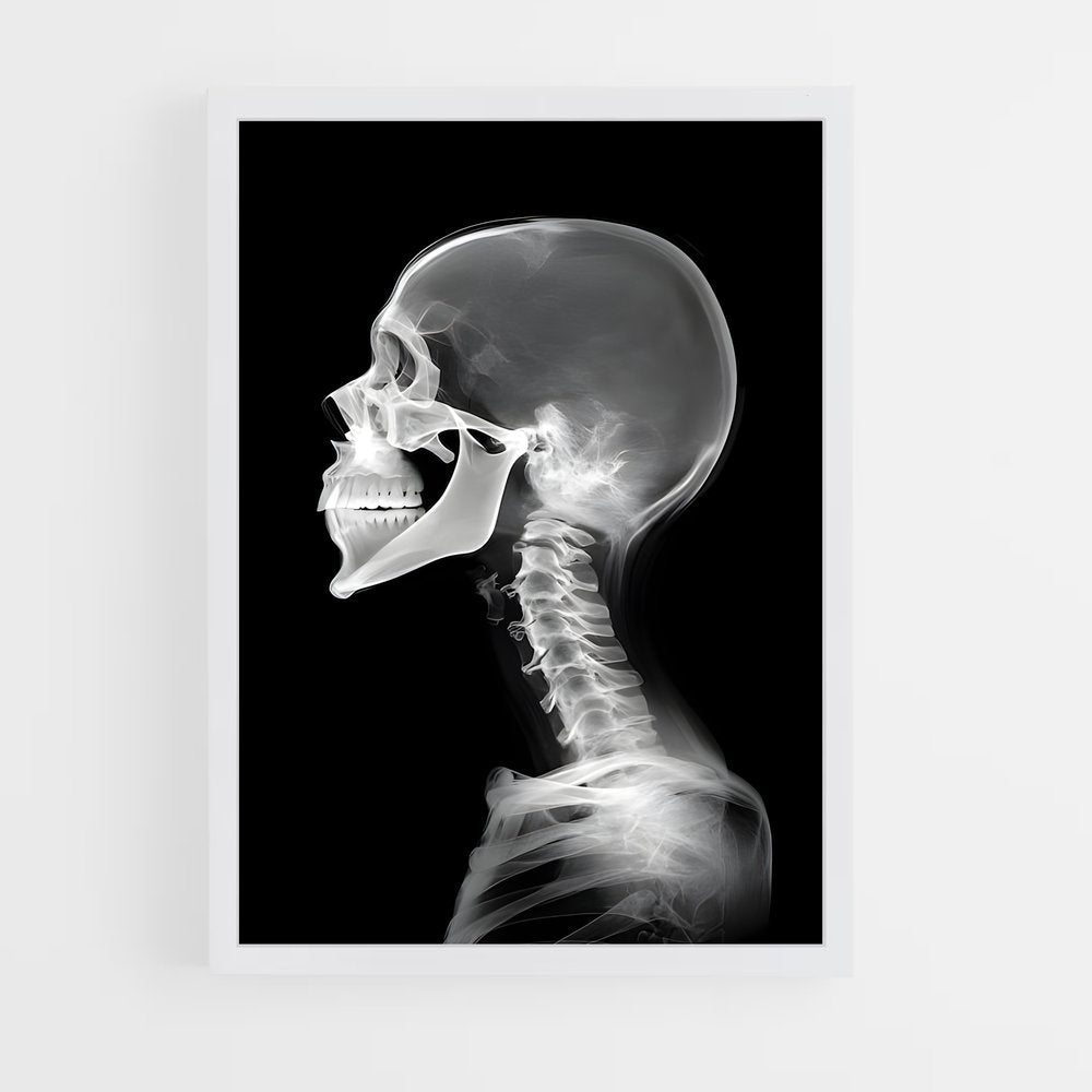 ap-x-rays-1 cadre Blanc