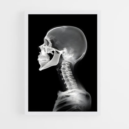 ap-x-rays-1 cadre Blanc