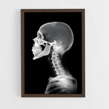 ap-x-rays-1 cadre Bois foncé