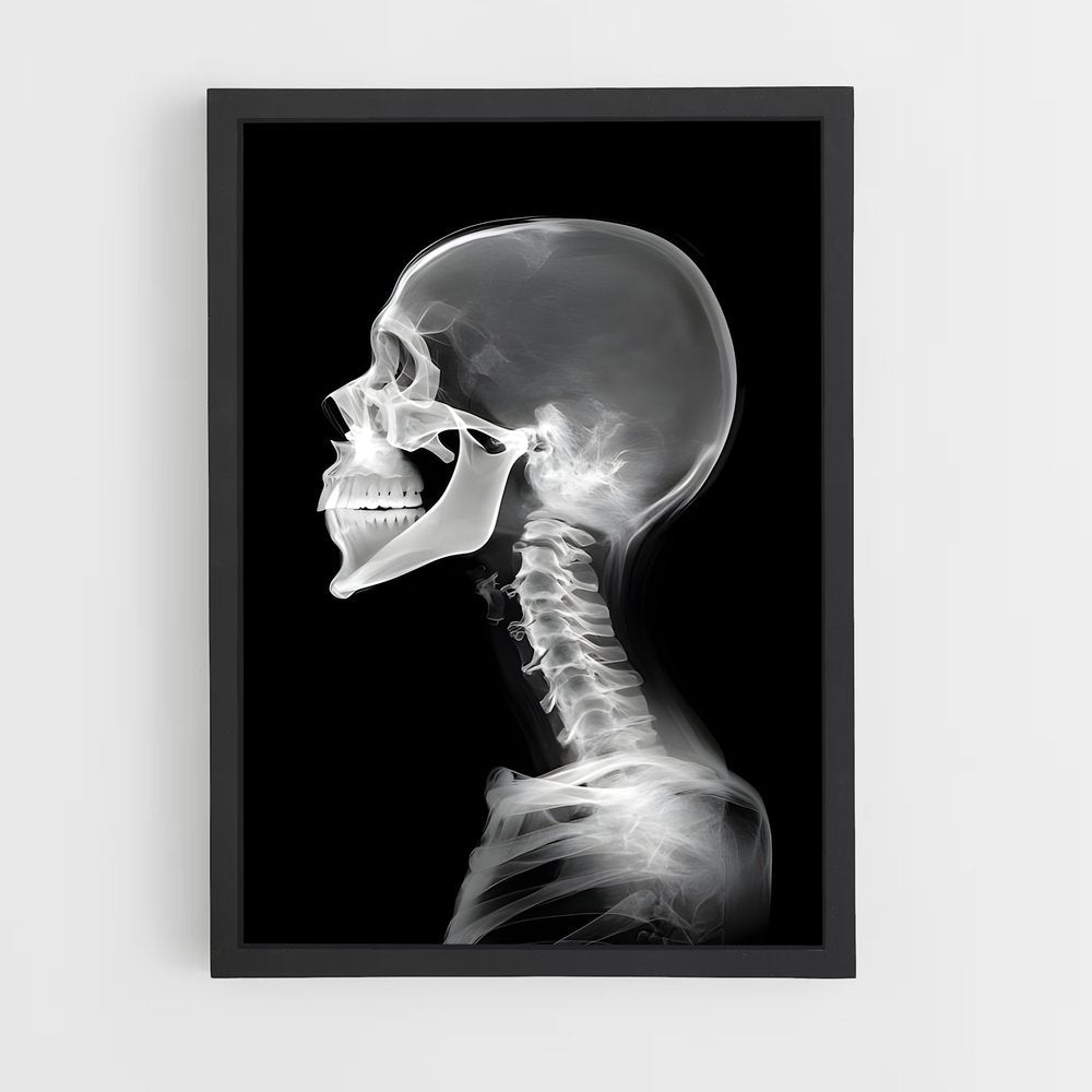 ap-x-rays-1 cadre Noir