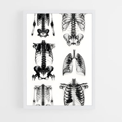 ap-x-rays-3 cadre Blanc